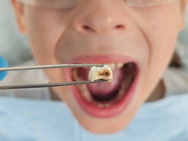 Best Emergency Cosmetic Dentistry in Birngham, MI